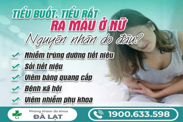 Hình ảnh minh họa